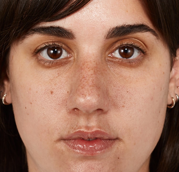 complexion before